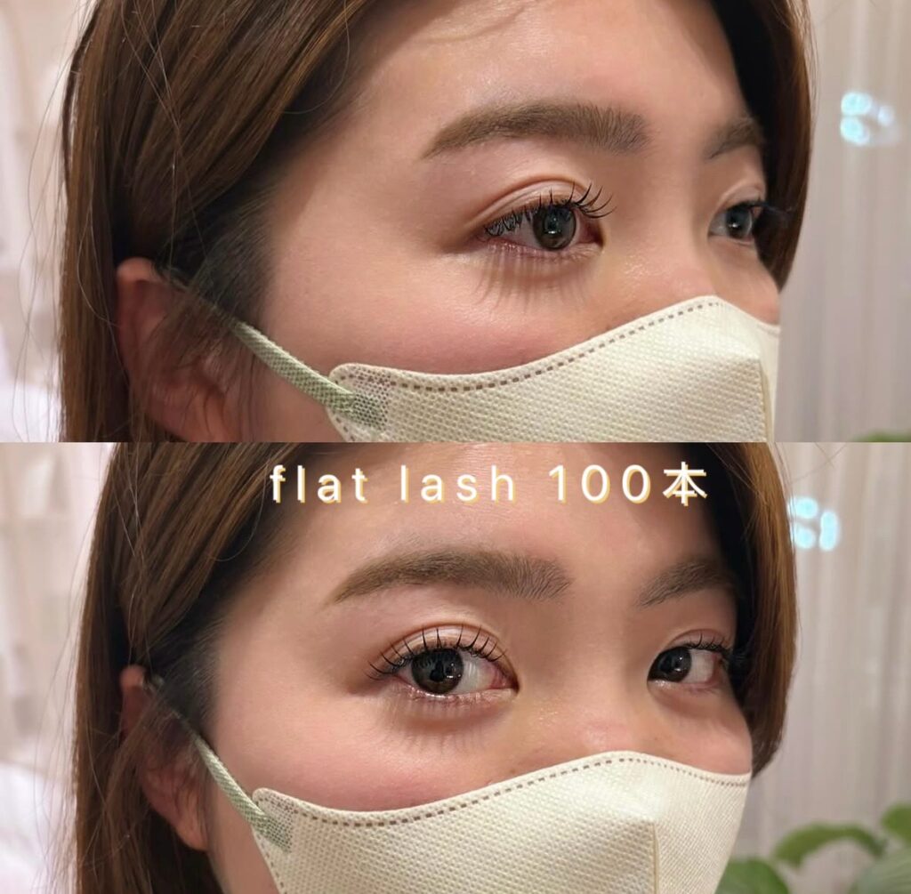フラットラッシュ100本